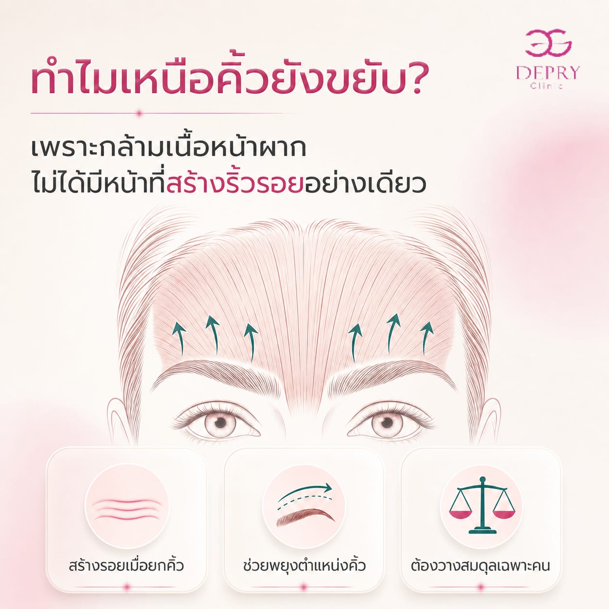 ภาพอธิบายกล้ามเนื้อหน้าผากที่สร้างริ้วรอยและช่วยพยุงคิ้ว