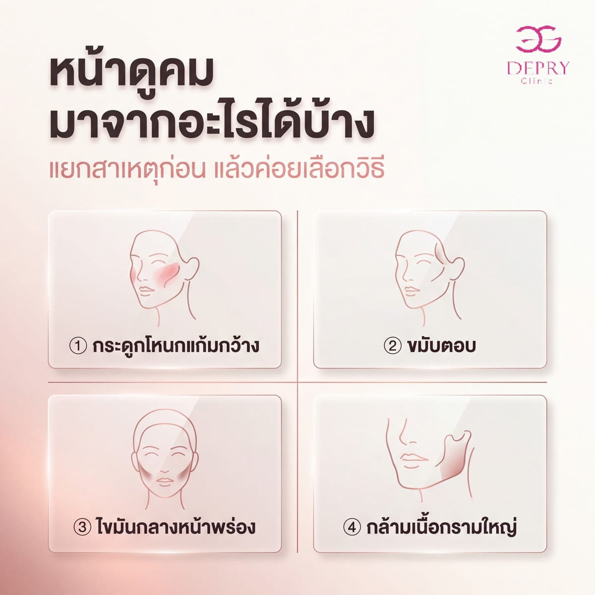 อินโฟกราฟิกแยก 4 สาเหตุที่ทำให้ใบหน้าดูคม: กระดูกโหนกแก้มกว้าง ขมับตอบ ไขมันกลางหน้าพร่อง และกล้ามเนื้อกรามใหญ่