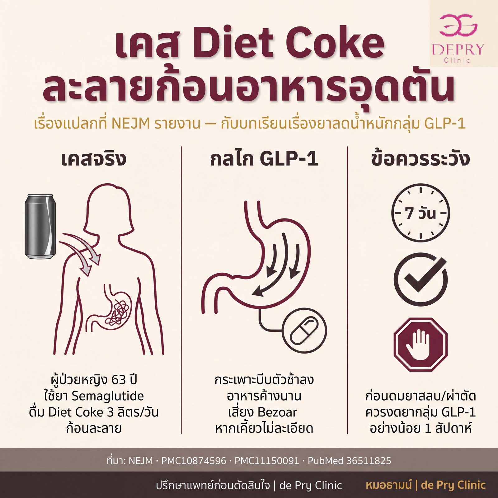 เคส Diet Coke ละลายก้อนอาหารอุดตัน — NEJM + กลไก GLP-1