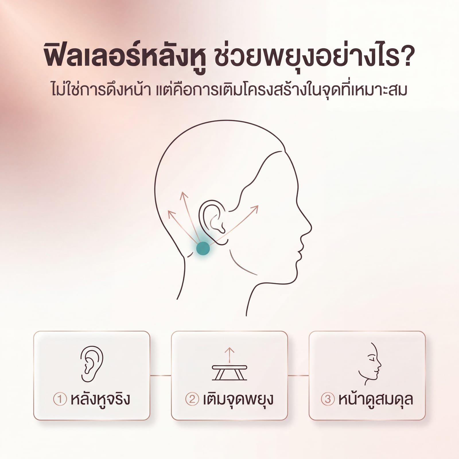 Infographic na nagpapaliwanag ng support points malapit sa tenga at facial support