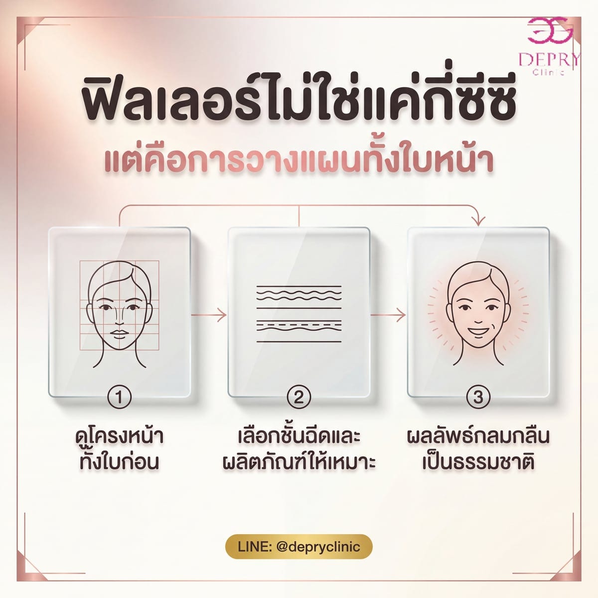 อินโฟกราฟิกสรุป 3 ขั้นตอนการวางแผนฉีดฟิลเลอร์: ดูโครงหน้าทั้งใบก่อน เลือกชั้นฉีดและผลิตภัณฑ์ให้เหมาะ ผลลัพธ์กลมกลืนเป็นธรรมชาติ