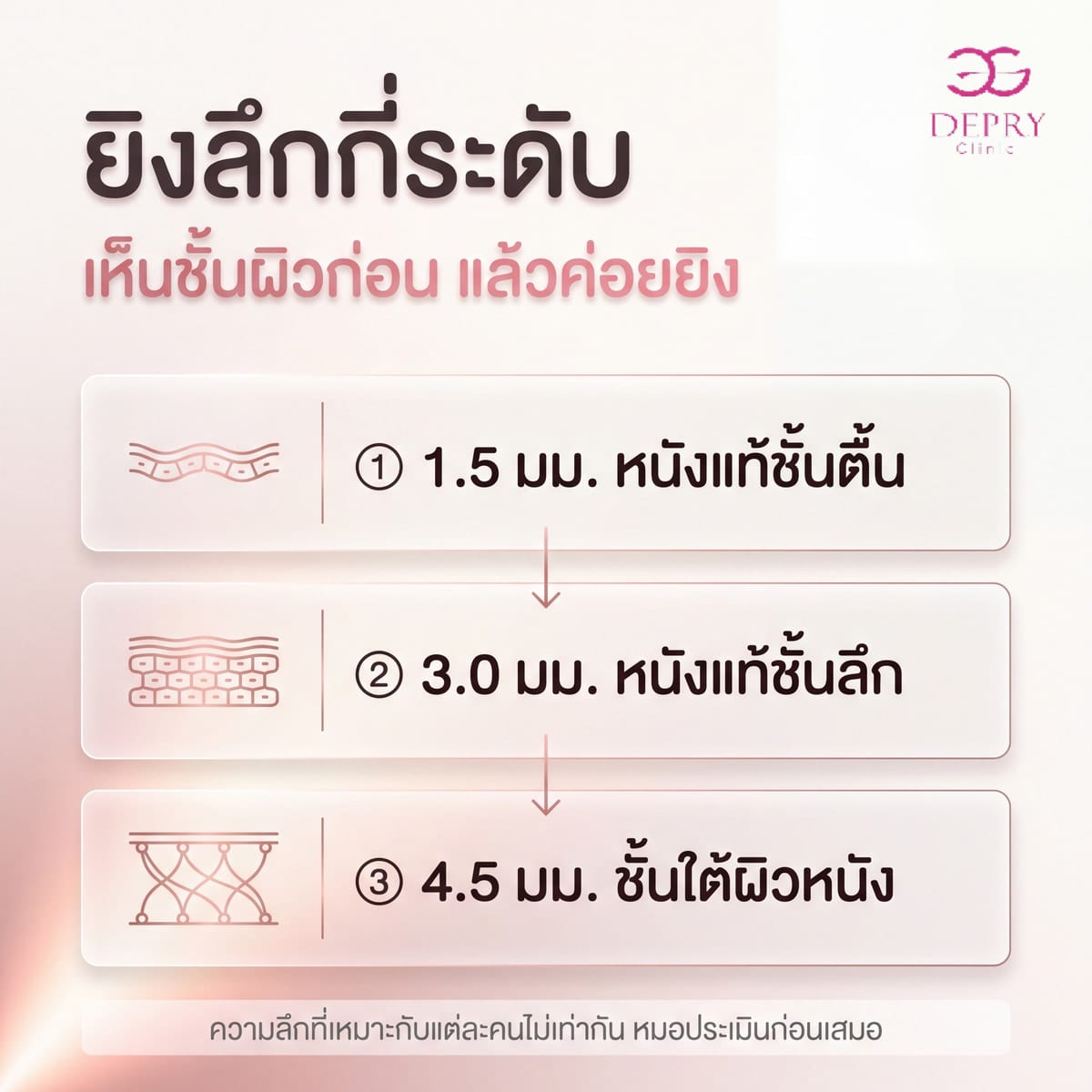 อินโฟกราฟิกแสดงระดับความลึกที่อัลเทอร่ายิงพลังงาน: 1.5 มิลลิเมตรที่หนังแท้ชั้นตื้น 3.0 มิลลิเมตรที่หนังแท้ชั้นลึก และ 4.5 มิลลิเมตรที่ชั้นใต้ผิวหนัง