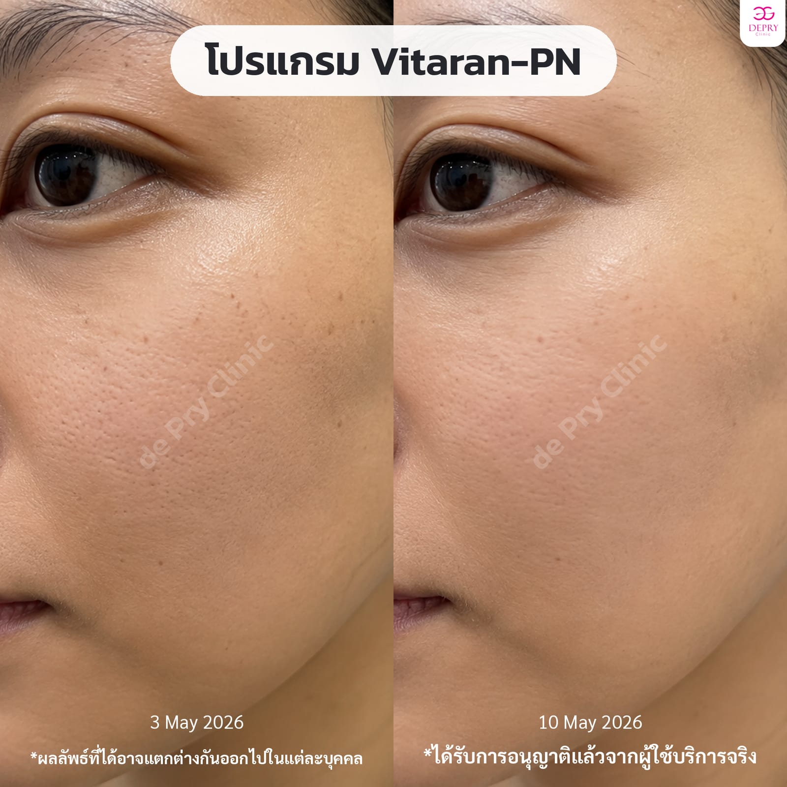 ผลลัพธ์ก่อนและหลังการรักษา