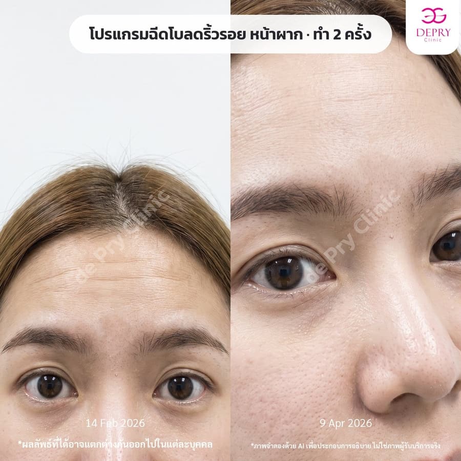 ผลลัพธ์ก่อนและหลังการรักษา