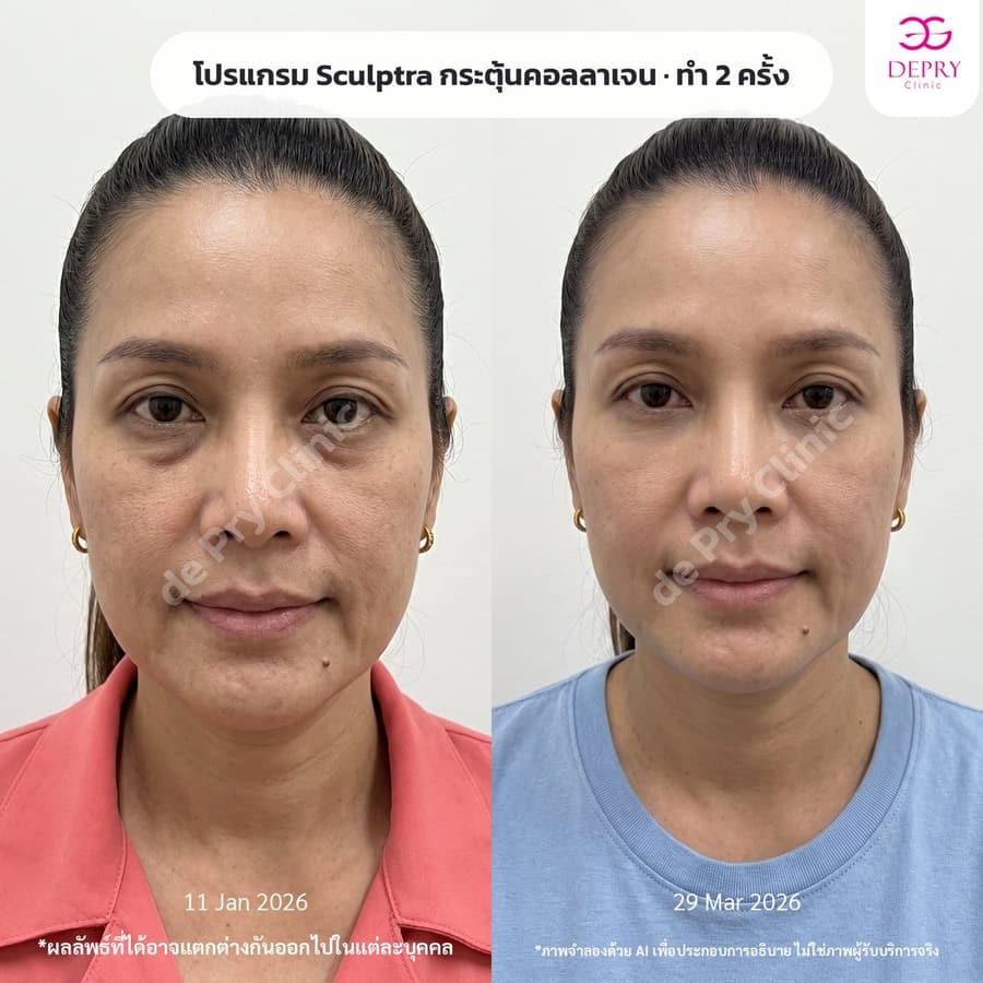ผู้หญิง ก่อน–หลัง หลังทำ 2 ครั้ง