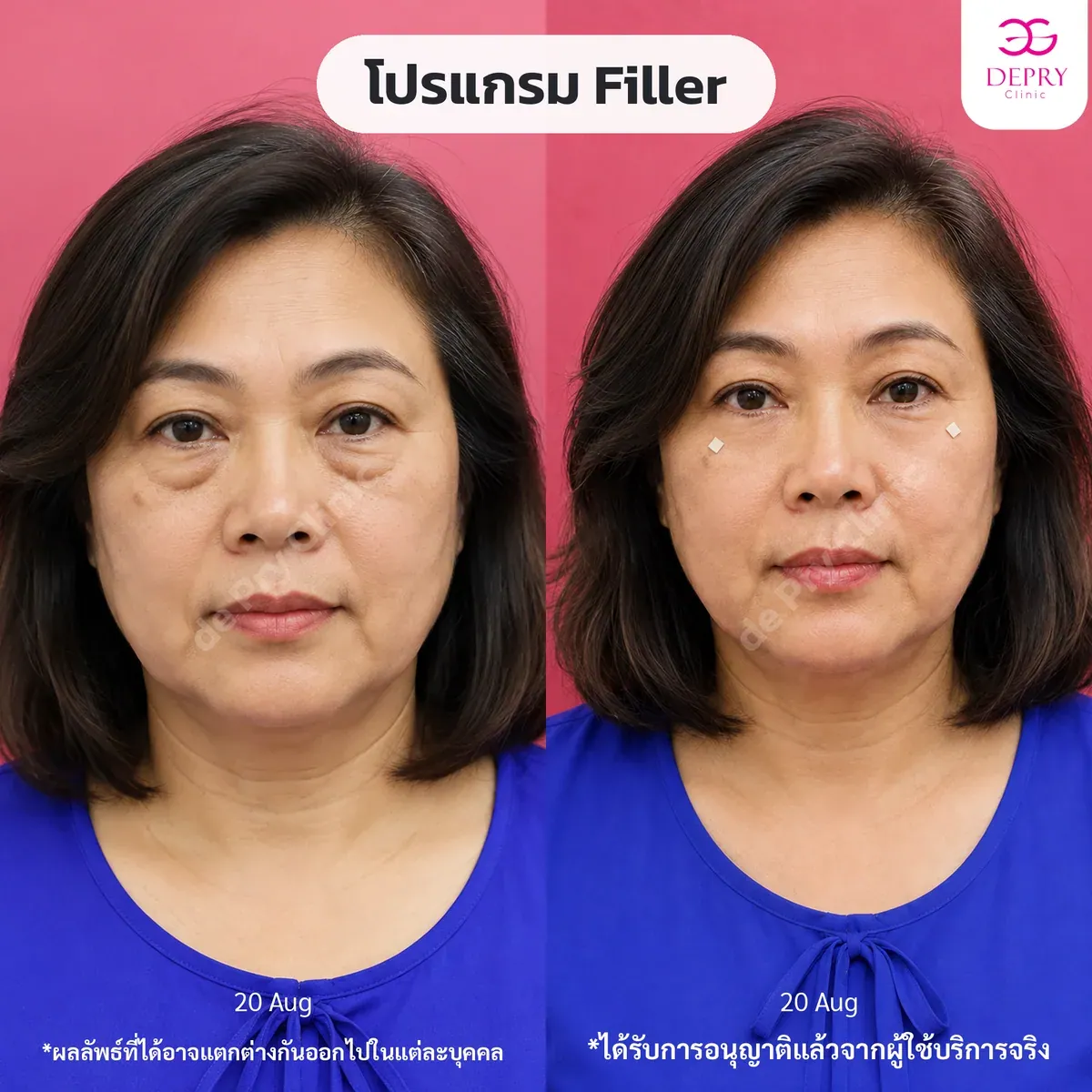 ผลลัพธ์ก่อนและหลังการรักษา