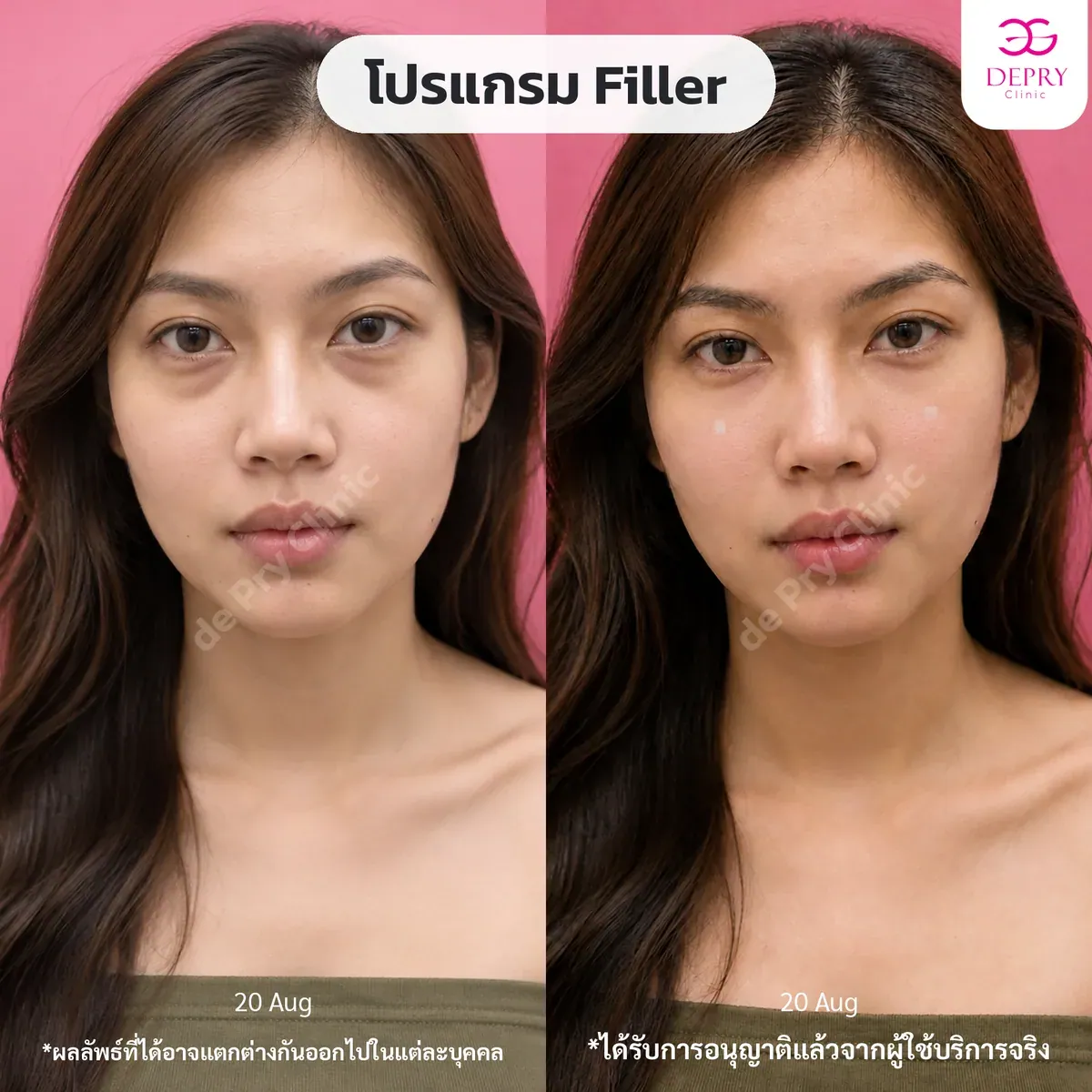 ผลลัพธ์ก่อนและหลังการรักษา
